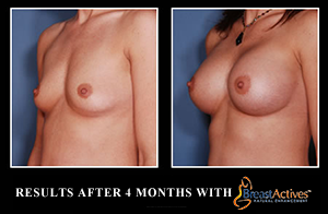breast-actives-works-before-and-after